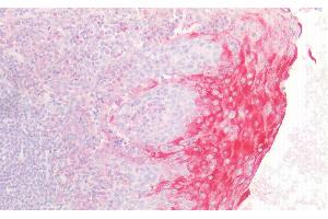 Detection of DGKa in Human Tonsil Tissue using Polyclonal Antibody to Diacylglycerol Kinase Alpha (DGKa) (DGKA antibody  (AA 305-531))