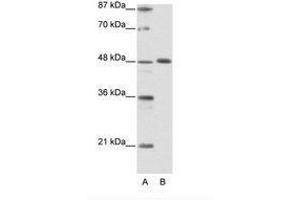 Image no. 1 for anti-Zinc Finger Protein 259 (znf259) (C-Term) antibody (ABIN6736147) (ZNF259 antibody  (C-Term))