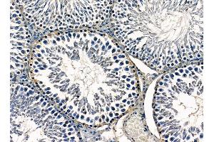 ABIN7095319 and ABIN7099376 at 1/100 staining rat testis tissue by IHC-P.
