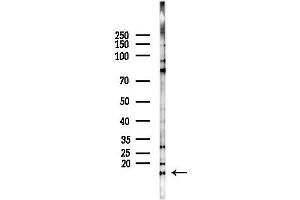 Western blot analysis of lysates from PC12 cells, using Tri-Methyl-Histone H3 (Lys9)/H3K9me3 Antibody at 1/1000 dilution.