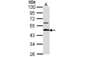 WB Image Sample (30 ug of whole cell lysate) A: A431 , 10% SDS PAGE antibody diluted at 1:1000 (APBB3 antibody  (Center))