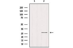 Western blot analysis of extracts from Hela, using RAB33B Antibody. (RAB33B antibody  (Internal Region))