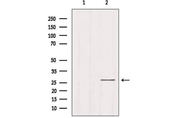 RAB33B antibody  (Internal Region)