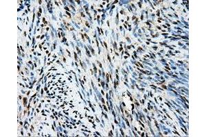 Immunohistochemical staining of paraffin-embedded endometrium tissue using anti-TIPRLmouse monoclonal antibody. (TIPRL antibody)