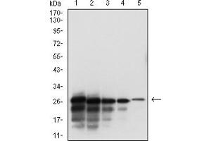 Western blot analysis using SARS-CoV-2-NP3 mAb against human SARS-CoV-2-N (AA: 240-419) recombinant protein. (SARS-CoV-2-NP3 (AA 240-419) antibody)
