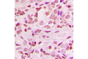 Immunohistochemistry (IHC) image for anti-Nuclear Factor of kappa Light Polypeptide Gene Enhancer in B-Cells Inhibitor, alpha (NFKBIA) (N-Term) antibody (ABIN7296426)