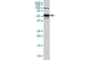 STK38 monoclonal antibody (M05), clone 6G11 Western Blot analysis of STK38 expression in Hela S3 NE . (STK38 antibody  (AA 365-465))