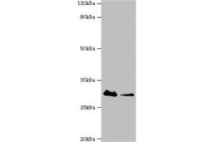 Western blot All lanes: Carbonyl reductase [NADPH] 3 antibody at 10 μg/mL Lane 1: Hela whole cell lysate Lane 2: K562 whole cell lysate Secondary Goat polyclonal to rabbit IgG at 1/10000 dilution Predicted band size: 31 kDa Observed band size: 31 kDa