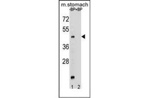 Western blot analysis of MBOAT4 Antibody (Center) Cat. (MBOAT4 antibody  (Middle Region))