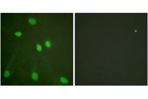 Immunofluorescence analysis of HeLa cells, using Histone H3 (Ab-14) Antibody. (Histone 3 antibody  (AA 6-55))