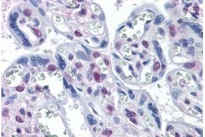 Human Placenta: Formalin-Fixed, Paraffin-Embedded (FFPE) (STK17A antibody  (AA 301-414))