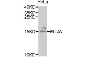 Western blot analysis of extracts of HeLa cells, using MT2A antibody. (MT2A antibody)