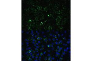 Immunofluorescence (IF) image for anti-Aldehyde Dehydrogenase 1 Family, Member A2 (ALDH1A2) (AA 1-180) antibody (ABIN6136765)