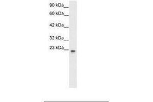 Image no. 2 for anti-General Transcription Factor IIF, Polypeptide 2, 30kDa (GTF2F2) (AA 132-181) antibody (ABIN6735771) (GTF2F2 antibody  (AA 132-181))