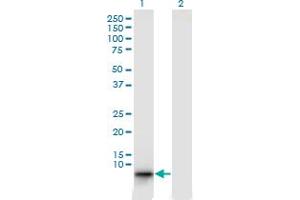 Western Blot analysis of EBF4 expression in transfected 293T cell line by EBF4 monoclonal antibody (M04), clone 4E10.