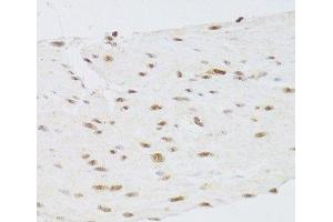 Immunohistochemistry of paraffin-embedded Human stomach using CSRP3 Polyclonal Antibody at dilution of 1:100 (40x lens).