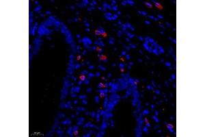 Immunofluorescence of paraffin embedded human appendix using MADCAM1 (ABIN7074695) at dilution of 1:1800 (400x lens) (MADCAM1 antibody)