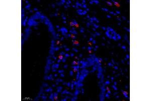 Immunofluorescence of paraffin embedded human appendix using MADCAM1 (ABIN7074695) at dilution of 1:1800 (400x lens) (MADCAM1 antibody)