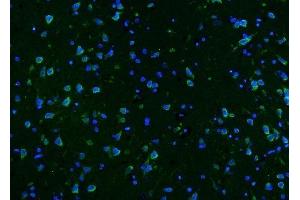 anti-Calcium/calmodulin-Dependent Protein Kinase II alpha (CAMK2A) (AA 1-478) antibody