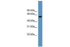 Western Blot showing RAP1GDS1 antibody used at a concentration of 1. (RAP1GDS1 antibody  (Middle Region))