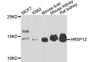 Western blot analysis of extracts of various cell lines, using HRSP12 antibody (ABIN5972464) at 1/1000 dilution. (HRSP12 antibody)