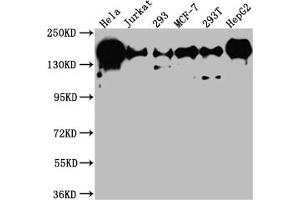 Western Blot Positive WB detected in: Hela whole cell lysate, Jurkat whole cell lysate, 293 whole cell lysate, MCF-7 whole cell lysate, 293T whole cell lysate, HepG2 whole cell lysate All lanes: PELP1 antibody at 1:1000 Secondary Goat polyclonal to rabbit IgG at 1/50000 dilution Predicted band size: 120 kDa Observed band size: 160 kDa (Recombinant PELP1 antibody)