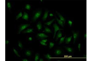 Image no. 2 for anti-Transcription Factor 19 (TCF19) (AA 17-103) antibody (ABIN598965) (TCF19 antibody  (AA 17-103))