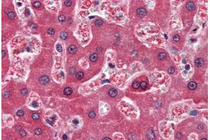 Human Liver (formalin-fixed, paraffin-embedded) stained with RBP4 antibody ABIN364444 at 10 ug/ml followed by biotinylated anti-mouse IgG secondary antibody ABIN481714, alkaline phosphatase-streptavidin and chromogen. (RBP4 antibody  (AA 19-201))