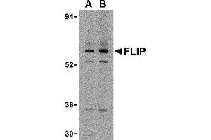 Western Blotting (WB) image for anti-CASP8 and FADD-Like Apoptosis Regulator (CFLAR) (N-Term) antibody (ABIN1031381) (FLIP antibody  (N-Term))