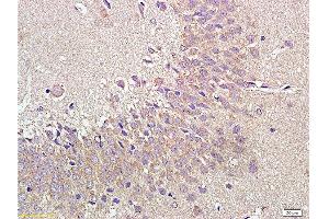 Immunohistochemistry (Paraffin-embedded Sections) (IHC (p)) image for anti-Neuropeptide Y Receptor Y1 (NPY1R) (AA 301-382) antibody (ABIN737211)