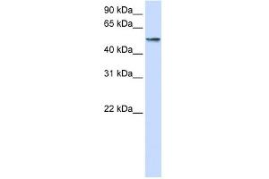 WB Suggested Anti-USP22 Antibody Titration: 0. (USP22 antibody  (Middle Region))