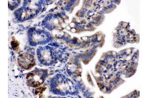 Talin 2 was detected in paraffin-embedded sections of mouse intestine tissues using rabbit anti- Talin 2 Antigen Affinity purified polyclonal antibody (Catalog # ) at 1 ? (TLN2 antibody  (Middle Region))