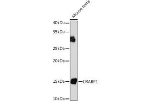 Western blot analysis of extracts of Mouse testis, using CR Rabbit mAb (ABIN7266269) at 1:1000 dilution. (CRABP1 antibody)