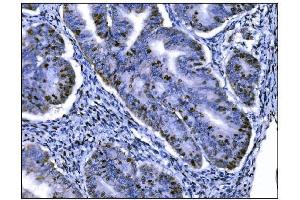 IHC analysis of Ki67 using anti-Ki67 antibody (ABIN7601100).