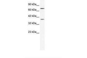 Image no. 1 for anti-Zinc Finger Protein 660 (ZNF660) (C-Term) antibody (ABIN202267) (ZNF660 antibody  (C-Term))