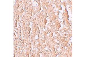 Immunohistochemistry (IHC) image for anti-Solute Carrier Family 39 (Zinc Transporter), Member 10 (SLC39A10) (Middle Region) antibody (ABIN1031176) (SLC39A10 antibody  (Middle Region))