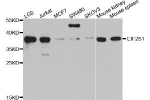 Western blot analysis of extracts of various cell lines, using EIF2S1 antibody (ABIN5970287) at 1/1000 dilution. (EIF2A antibody)