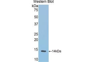 Detection of Recombinant HB, Cattle using Polyclonal Antibody to Hemoglobin (HB) (Hemoglobin antibody)
