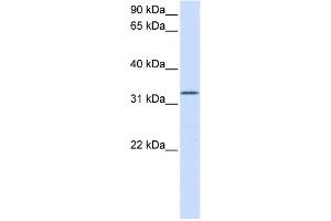 WB Suggested Anti-DOK5 Antibody Titration:  0. (DOK5 antibody  (N-Term))