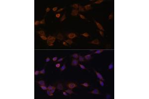 Immunofluorescence analysis of NIH-3T3 cells using CYPOR Polyclonal Antibody (ABIN6130227, ABIN6145969, ABIN6145970 and ABIN7101824) at dilution of 1:100 (40x lens).