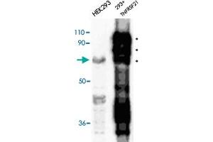 Immunodetection of transfected human TNFRSF21 in HEK 293 cells using TNFRSF21 polyclonal antibody . (TNFRSF21 antibody  (AA 372-665))