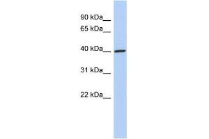 WB Suggested Anti-DDI1 Antibody Titration: 0. (DDI1 antibody  (Middle Region))