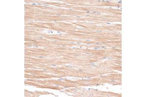Immunohistochemistry of paraffin-embedded rat heart using BCL2 antibody (ABIN6291793) at dilution of 1:100 (40x lens).