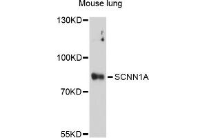 Western blot analysis of extracts of mouse lung, using SCNN1A antibody (ABIN5973225) at 1/1000 dilution. (SCNN1A antibody)