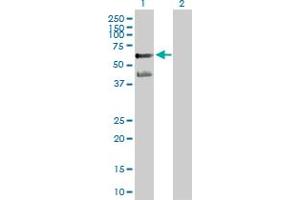 Western Blot analysis of PPARA expression in transfected 293T cell line by PPARA MaxPab polyclonal antibody. (PPARA antibody  (AA 1-468))