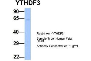 Host: Rabbit  Target Name: YTHDF3  Sample Tissue: Human Fetal Heart  Antibody Dilution: 1.