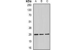 Western blot analysis of C4BP beta expression in HepG2 (A), mouse testis (B), rat testis (C) whole cell lysates.