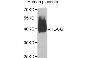 Western blot analysis of extracts of human placenta, using HLA-G antibody (ABIN5974455) at 1/1000 dilution. (HLAG antibody)