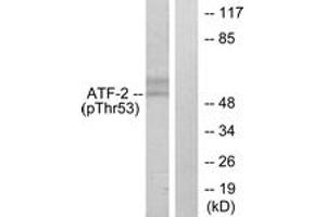 Western blot analysis of extracts from HeLa cells treated with UV, using ATF2 (Phospho-Thr71 or 53) Antibody. (ATF2 antibody  (pThr71))