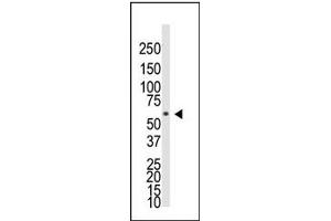 Image no. 1 for anti-Bone Morphogenetic Protein Receptor 1A (BMPR1A) (AA 39-69), (N-Term) antibody (ABIN357372) (BMPR1A antibody  (N-Term))